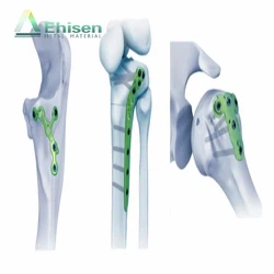 High quality Titanium bone plate High quality Titanium bone plate