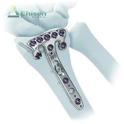 Titanium bone plate manufacturers Titanium bone plate manufacturers